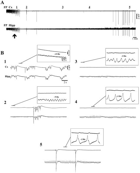 Isoflurane induction of deep coma, including the EEG isoelectric line ...