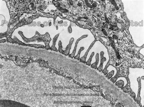 Basement Membrane Dr Jastrow S Electron Microscopic Atlas