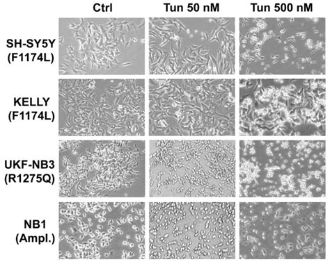 Photomicrographs Of Alk Positive Nb Cell Lines Alk Positive Nb Cell