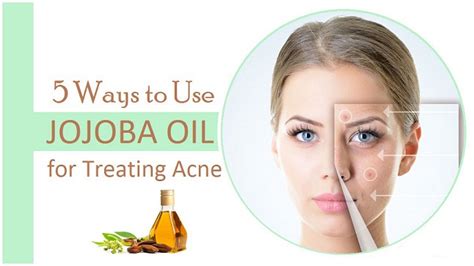 Jojoba Oil To Get Rid Of Acne And Face Scars I Fashion Styles