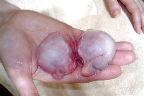 Kastriert Trannies Kastration Orchectomy Porno Bilder Sex Fotos XXX Bilder PICTOA