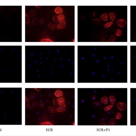 Puerarin Reduced The Sma Expression Induced By H R In Vitro Before