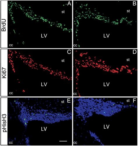 Svz Cell Proliferation In Juvenile Animals Fluorescent Download