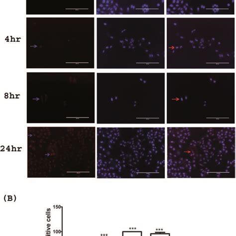 A Time Dependent Intracellular Distribution Of Hsnpc In Hela Cells