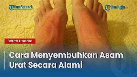 Cara Menyembuhkan Asam Urat Secara Alami Youtube