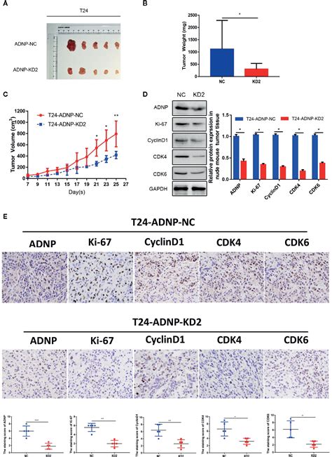 Frontiers Adnp Upregulation Promotes Bladder Cancer Cell