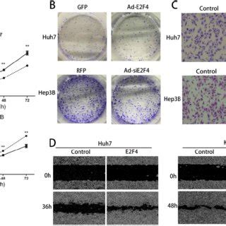 E2F4 Can Promote Cell Cycle Progression Of Hepatocellular Carcinoma