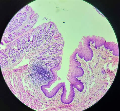 Rectal Anal Histology X Diagram Quizlet
