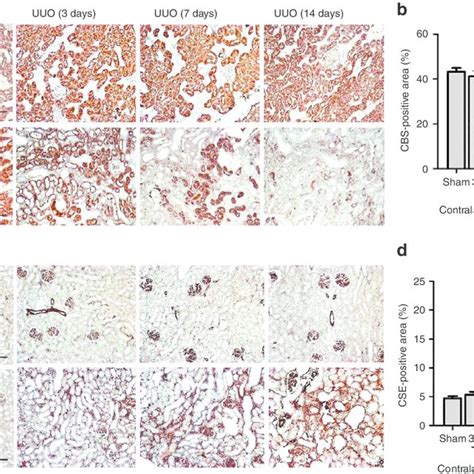 | Expression and localization of cystathionine-b-synthase (CBS) and ... 