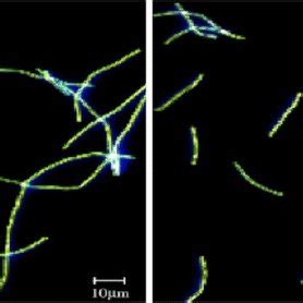 Microscope images of Bacillus thuringiensis before (left) and after ...