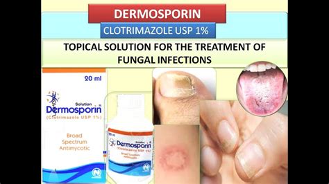 Clotrimazole To Treat Nail Fungus Nail Ftempo