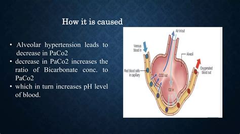 Respiratory Alkalosis Ppt