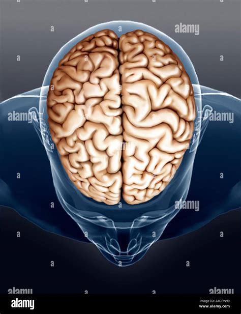 Human Brain Coloured Magnetic Resonance Imaging MRI Scan Of A Top