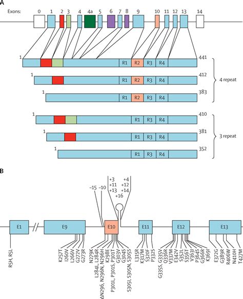 Tau Pathology And Neurodegeneration The Lancet Neurology