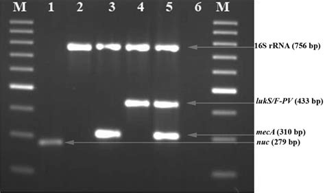 Representative Results Of Single And Multiplex Pcr For The Detection Of