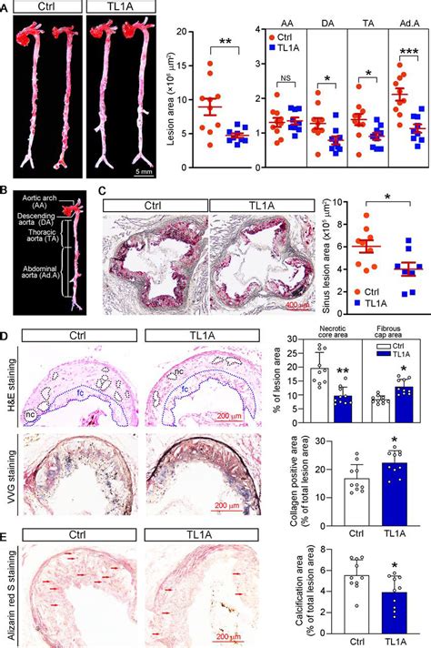 Tl1a Inhibits Atherosclerosis In Apoe Deficient Mice By Regulating The