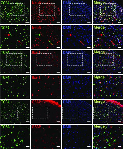 TCF4 Expression And Localization In BCP TCF4 Green NeuN Red