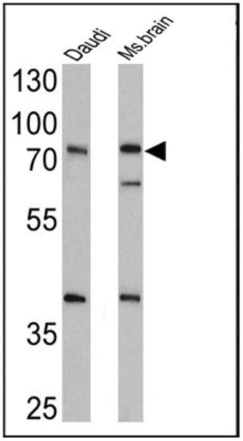 Epithelial Sodium Channel Alpha Antibody Novus Biologicals 0 1mg