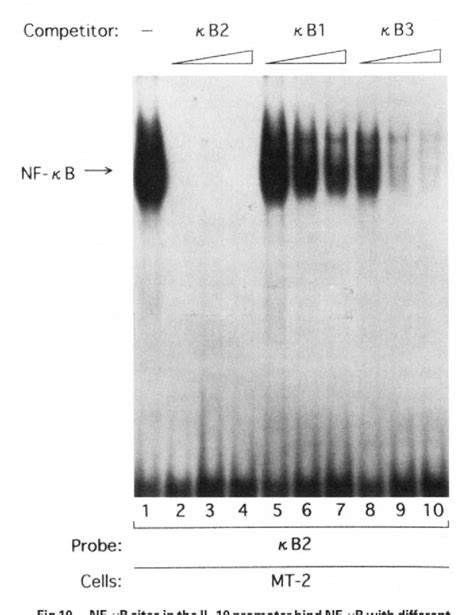 [PDF] Interleukin-10 gene expression in adult T-cell leukemia. | Semantic Scholar