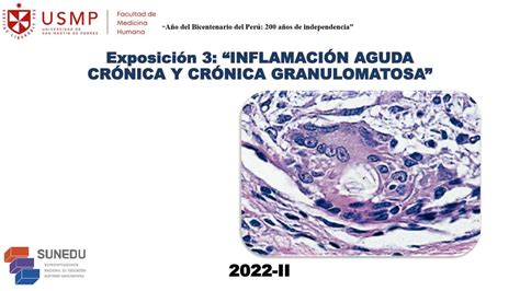 Inflamación Aguda Crónica Granulomatosa Briggitte Yamilé Suarez