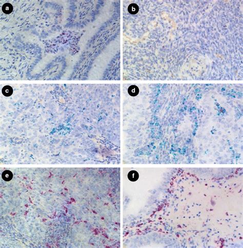 Expression of macrophage marker CD11b (red) in combination with FOLR2... | Download Scientific ...