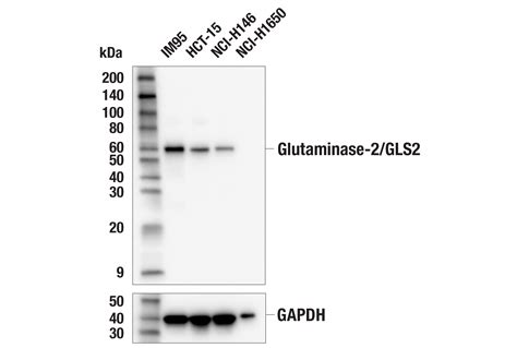 Glutaminase Gls E C V Rabbit Mab Cell Signaling Technology