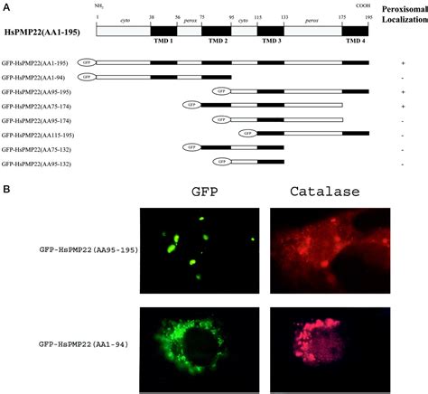 Two Different Targeting Signals Direct Human Peroxisomal Membrane