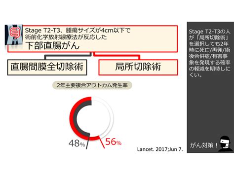 日本がん対策図鑑 【直腸がん：手術】「局所切除術」vs「直腸間膜全切除術」