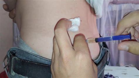 Injection In Ass Video Thisvid