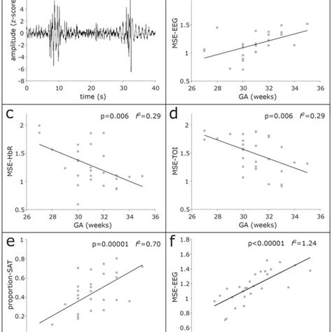 A An Example Of EEG Recording In A Preterm Neonate Displaying SAT B