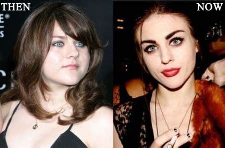 Frances Bean Cobain Perfect Plastic Surgery