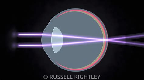 Russell Kightley Scientific Animations Focusing In A Human Eye Rights