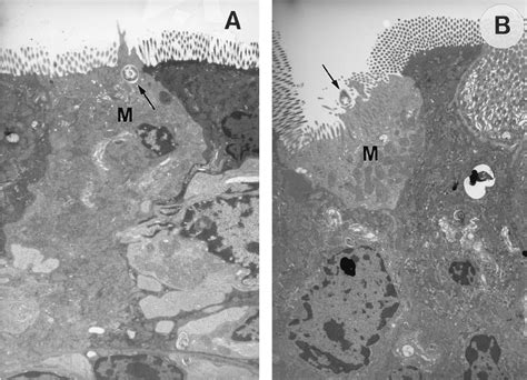 Transmission Electron Microscopy Of S Typhimurium Mutant Download