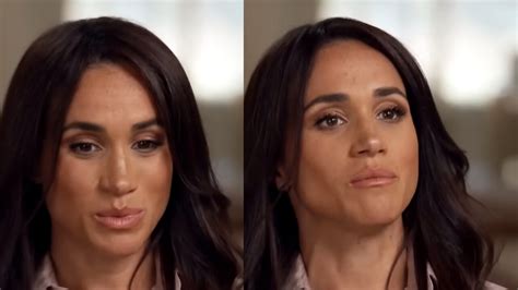 Meghan Markle Torna A Parlare Di Suicidio Nessuno Deve Fare Quei