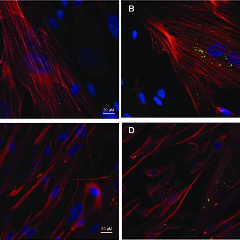 Fluorescence Microscopy Analysis Of Rhodamine Phalloidin Labelled