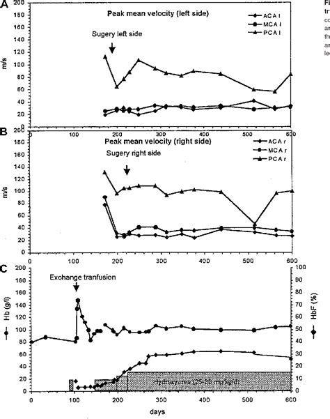 Figure 1 From Stroke In Hemoglobin Sd Sickle Cell Disease With Moyamoya Successful