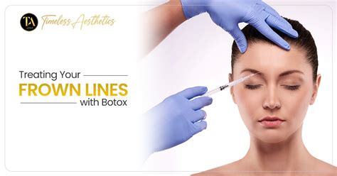 Unlocking the Power of Botox for Frown Line Treatment