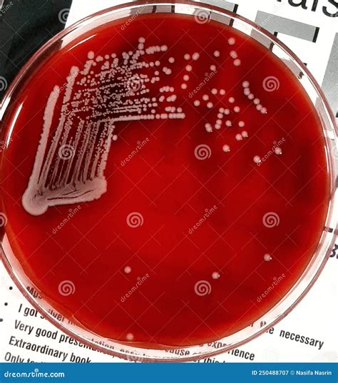 E Coli On Blood Agar