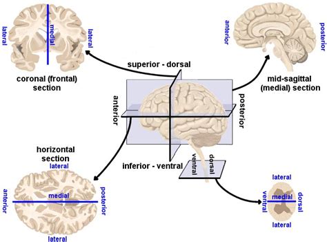 Planes Of Orientation Brain Dissection