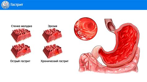 Учреждение здравоохранения "Щучинская центральная районная больница ...