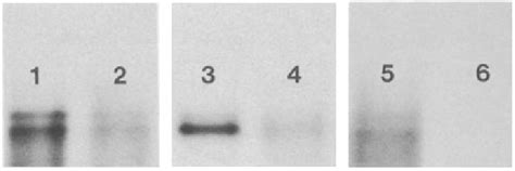 Autoradiograms Of Rna Filter Blots Hybridized To 32p Labeled Erythroid