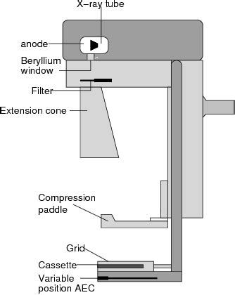 Figure 1 from Digital Mammography: Improvements in Breast Cancer Diagnostic | Semantic Scholar