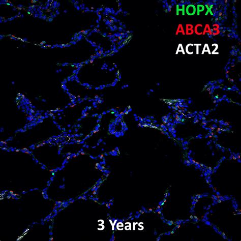 Year Human Lung Hopx Abca And Acta Confocal Imaging