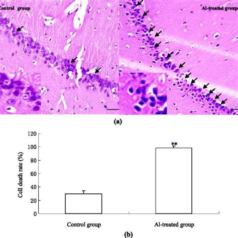 Morphological changes of rat hippocampal neuron induced by aluminium ... 