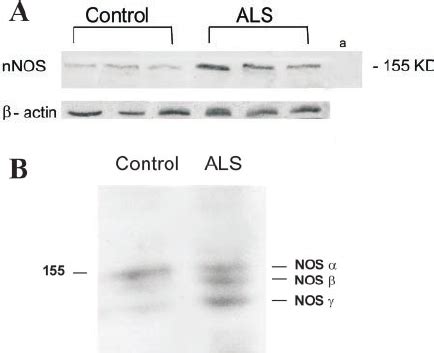 Expression Of NNOS In Total Homogenates From Control And SALS Spinal