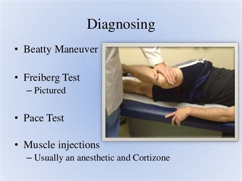 Piriformis Syndrome