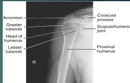 Humerus Shoulder Flashcards Quizlet