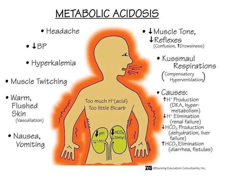 Pin By Rebecca Reischl On Nurse Stuff Nursing Mnemonics Metabolic Acidosis Nurse Manager