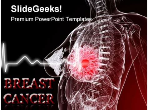 Breast Cancer Powerpoint Template | Creative Design Templates