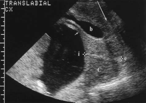 Obstetric Ultrasound–Second and Third Trimester | Radiology Key